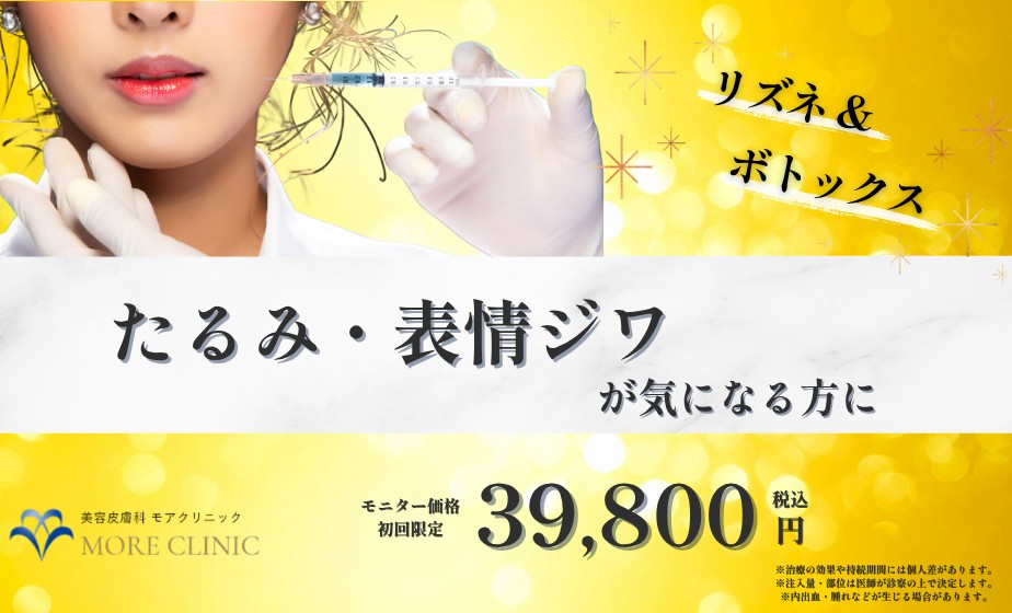 リズネ ボトックス